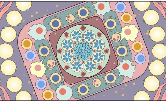Cachexia: How do immune responses contribute to weight loss?