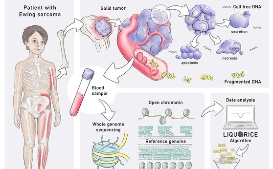 Blood test detects childhood tumors based on their epigenetic profiles