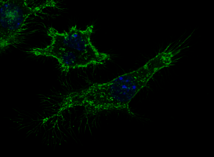 How Macrophages Settle Down How Macrophages Settle Down