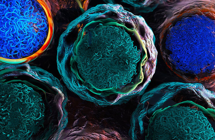 Finding second hits to knock out leukemia