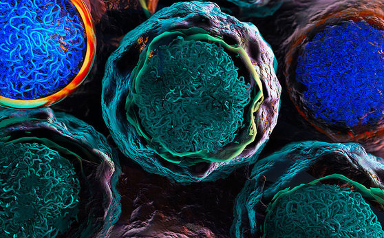 Finding second hits to knock out leukemia Finding second hits to knock out leukemia