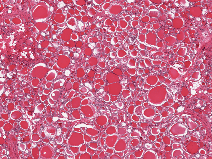 Organs age at different speeds: a blood test might soon tell which ones