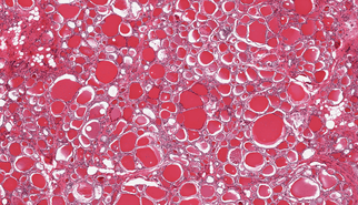 Organs age at different speeds: a blood test might soon tell which ones