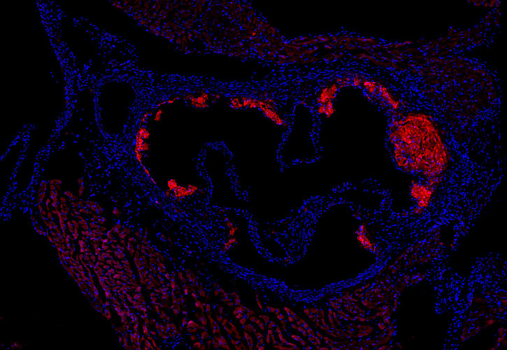 Protective Mechanism against Atherosclerosis Discovered