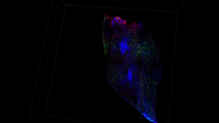 Basophils - underestimated players in lung development 