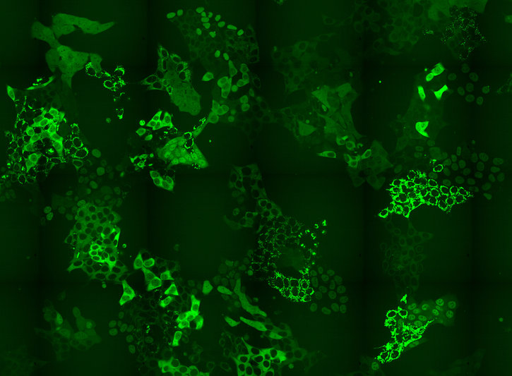 Drug discovery: First highly scalable method developed to monitor protein levels and localizations in cells Drug discovery: First highly scalable method developed to monitor protein levels and localizations in cells