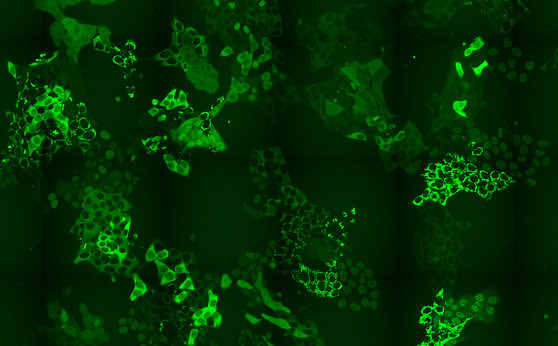 Drug discovery: First highly scalable method developed to monitor protein levels and localizations in cells