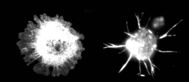 Faulty cytoskeleton impairs immune cells