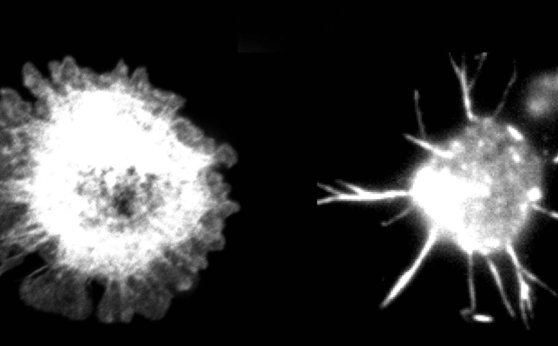 Faulty cytoskeleton impairs immune cells Faulty cytoskeleton impairs immune cells